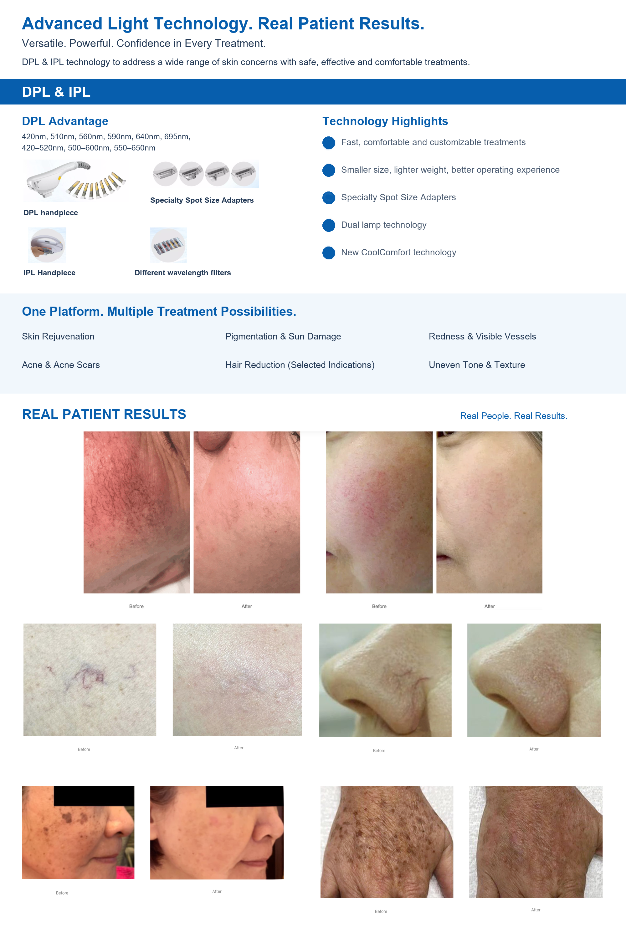ZenLight iQ Technology & Real Patient Results